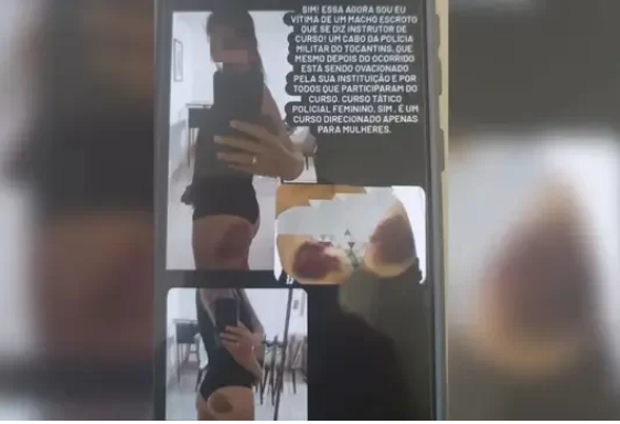 “Dor psicológica”: diz policial feminina vítima de agressão em curso